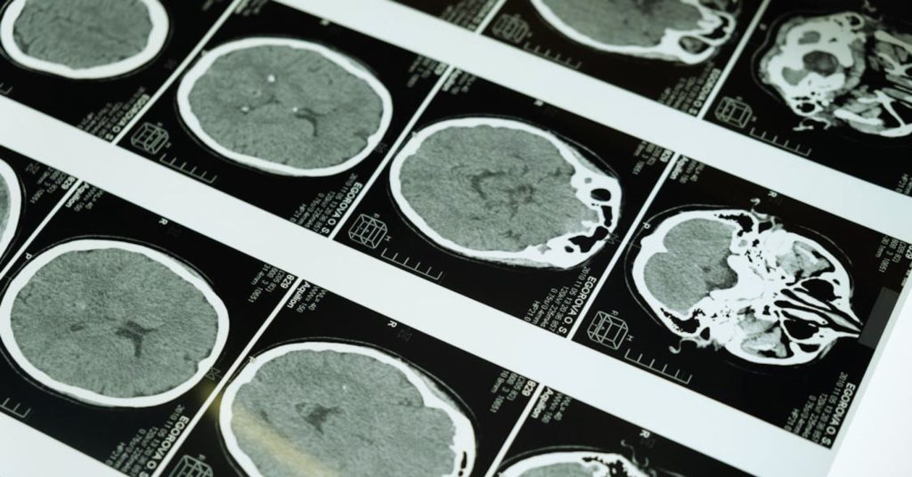 What is Neurologic Music Therapy